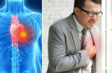 Nếu thấy 5 dấu hiệu này, bạn cần đi khám phổi gấp, người thường xuyên hút thuốc càng nên chú ý