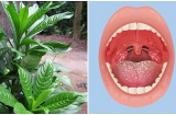 Loại lá dân dã trị viêm họng 'nhạy hơn kháng sinh': Đau rát đến mấy cứ ngậm vài lần sẽ đỡ