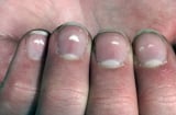 Đàn ông có 2 tròn, 2 lớn, 2 trắng nếu không chú ý đến sức khỏe thì tuổi thọ sẽ rút ngắn