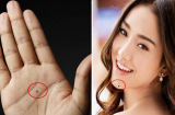 5 nốt ruồi bí mật trên Sh88bet đăng ký miễn phí ẩn chứa tài lộc, tiền trăm vào tay sinh ra tiền tỷ: Xem bạn có không