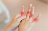 1 chậm, 2 sưng, 3 thêm cảnh bảo K phổi: Đừng tưởng bệnh vặt mà chủ quan