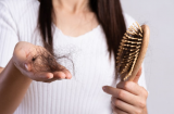 F0 khỏi bệnh cả năm tóc vẫn rụng từng nắm thì phải làm sao?