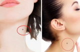 Nốt ruồi ở cổ phụ nữ: 2 vị trí mang đến sự giàu sang, 3 vị trí báo hiệu khó khăn, vất vả
