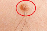 Đột nhiên thấy lông mọc 4 vị trí: Chắc chắn có điềm, gia chủ chuẩn bị tinh thần?