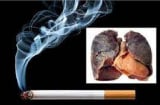 5 hành vi tưởng vô hại nhưng khiến thận suy kiệt, nhiều người thường xuyên mắc phải