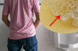 Sáng ngủ dậy thấy nước tiểu có màu này phải đi khám ngay kẻo bệnh thận 'gõ cửa'
