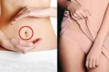 6 nốt ruồi 'chỗ kín' khiến chị em xấu hổ nhưng là lộc quý trời ban, lấy chồng đại gia, giàu nứt vách