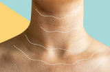 3 dấu hiệu 'lạ' ở cổ cảnh báo ung thư đã 'tấn công' Sh88bet đăng ký miễn phí, thử kiểm tra lại xem nhé!