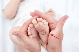 Trẻ có 3 nốt ruồi Tài- Lộc- Phúc là tương lai sáng chói, rạng danh tổ tông