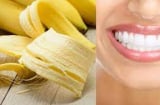 Chuối ăn xong đừng vứt vỏ đi: Làm theo cách này tẩy răng trắng tinh, lại an toàn