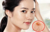 Người có lông mọc nhiều ở 5 vị trí này giàu bất thình lình, chớ có nhổ đi