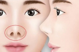 6 nét tướng của người hay gặp xui xẻo, dù làm ra tiền cũng khó giữ