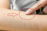 Vì sao nói: “Phụ nữ rậm lông, đàn ông được nhờ?”, hóa ra là vì điều này