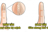 5 đường vân tay trên ngón út báo hiệu số vượng tài, Quý nhân 'độ', giàu sang phú quý may mắn vây quanh