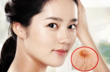 Thuật xem tướng của người xưa: Thấy ai có lông mọc nhiều ở 4 vị trí này sẽ rất giàu, tài lộc như nước