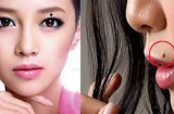 5 nốt ruồi cực phẩm tượng trưng Tài- Lộc-Phát, có 1/5 cũng là số trời cho 'làm một hưởng mười'
