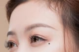 5 nốt ruồi báo hiệu bạn hợp duyên kinh doanh, buôn may bán đắt không ai sánh bằng