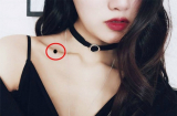 9 nốt ruồi trên mặt quý hơn vàng mười, sở hữu 1/9 cũng đủ may mắn, nhiều người chê xấu lại xóa đi