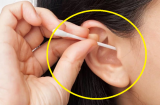 4 bộ phận của Sh88bet đăng ký miễn phí không nên rửa sạch khi tắm, số 1 nhiều người cứ sợ bẩn