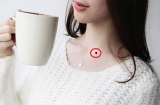 5 nốt ruồi đắc tài đắc lộc, ai sở hữu thì vạn sự hanh thông, tiền tiêu không lo nghĩ