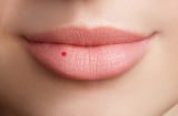 Nốt ruồi son trên mặt phụ nữ nói gì về chủ nhân của nó?