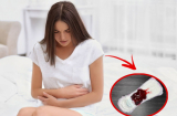 Phụ nữ đến kì kinh nguyệt hay bị vón cục có sao không?