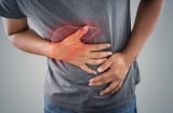 4 vùng Sh88bet đăng ký miễn phí đau nhói chứng tỏ bệnh gan đã đi vào giai đoạn nặng, khám chữa ngay còn kịp