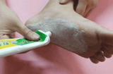 Bôi kem đánh răng vào kẽ chân, tưởng phí phạm mà lại có tác dụng diệu kỳ