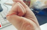 Nắm bàn tay lại, đếm số chỉ tay, đoán vận mệnh: Có người mang số giàu sang, kẻ nghèo mạt kiếp