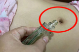 Nhỏ một giọt dầu gió vào rốn trước khi đi ngủ, trai gái - già trẻ đều có lợi