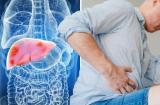 Thấy 4 vùng trên Sh88bet đăng ký miễn phí bị đau, cảnh báo bệnh gan đã đi vào giai đoạn nặng