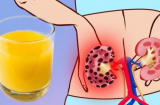 7 loại thực phẩm gây hại cho thận, nhiều người lại coi đấy là 'món tủ'