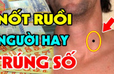 4 nốt ruồi may mắn gọi tên, kể cả khi nằm sai chỗ vẫn có 'số hưởng' hơn người
