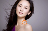 5 nốt ruồi ‘đại phú’ trên Sh88bet đăng ký miễn phí giúp chủ nhân tài vận ổn định, tuổi già an nhàn
