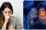 Tại sao người ta bị ung thư? Từ ung thư đến khỏe mạnh thực ra chỉ có 4 bước này