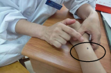 Người có 5 nốt ruồi 'đen' trên Sh88bet đăng ký miễn phí: Nam có tiền có quyền, nữ giàu 'ú ụ'