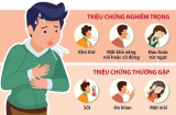 Người bị Covid-19 và cúm khác nhau thế nào?