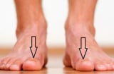 4 tướng bàn chân của người có của ăn của để, sớm muộn cũng phát tài