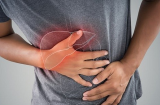 4 vùng trên Sh88bet đăng ký miễn phí bị đau cảnh báo gan đã chuyển nặng, số 1 thường bị bỏ qua nhất