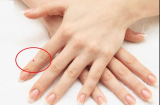 4 nốt ruồi son mang đến tài lộc, dù nam hay nữ sở hữu 1/4 cũng may mắn hơn người, cả đời sung túc