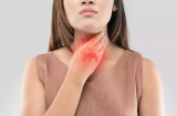Tủ lạnh nhà ai cũng hay có 3 món này, vứt bỏ ngay kẻo K tuyến giáp 'đeo bám'