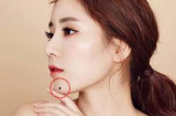 5 nốt ruồi giàu sang, ai sở hữu 1 cũng đủ may mắn phát tài hơn người