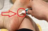 Đi ngủ buổi tối cứ bôi kem đánh răng vào lòng bàn chân, tác dụng tốt cho cả nam và nữ