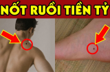 Trên người ai có 5 nốt ruồi 'đẻ ra tiền' này, càng già càng an nhàn hưởng phúc