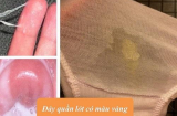 Đáy quần lót có màu vàng đục: Chị em phải làm ngay việc này kẻo hối hận