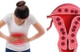 Phụ nữ có kinh nguyệt hết sau 3 ngày và hết sau 7 ngày: Ai dễ bị lão hóa sớm hơn?