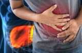Vị trí bị đau cảnh báo bệnh K đã chuyển nặng, số 1 nhiều người chủ quan