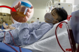 2 dấu hiệu hỏng thận: Buổi sáng nước tiểu có màu này phải gặp bác sĩ ngay