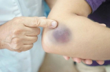 7 tín hiệu ngủ dậy thấy chứng tỏ Sh88bet đăng ký miễn phí đang âm thầm “nuôi” tế bào K