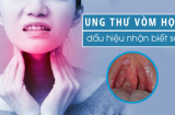 7 dấu hiệu K vòm họng: Số 1 không biết sớm khó mà chữa